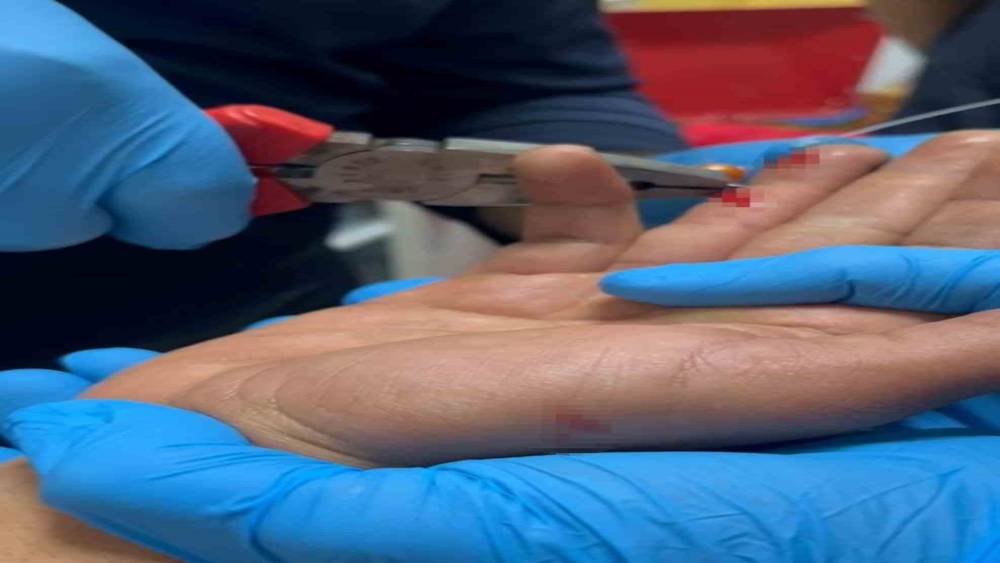 Balık macerası hastanede bitti: Parmağına saplanan olta iğnesini itfaiye çıkarttı
