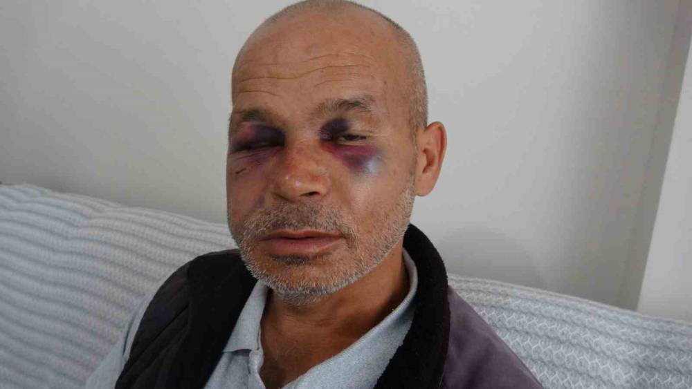 Engelli adamı darbeden ş&uuml;pheli serbest bırakıldı
