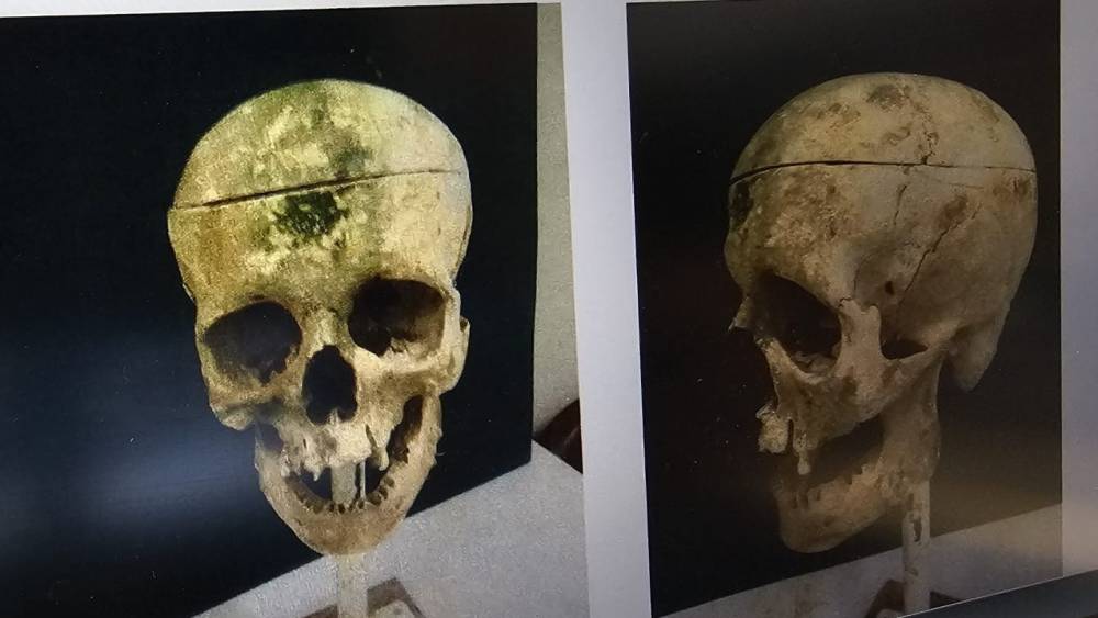 Barajdaki kemiklerle 18 yıllık cinayetin sırrı &ccedil;&ouml;z&uuml;ld&uuml;
