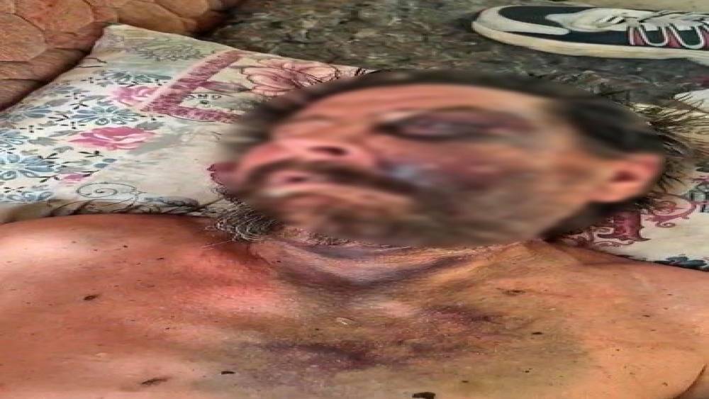 "Abimin cenazesine neden gelmedin" diyerek d&ouml;v&uuml;p &ouml;l&uuml;me terk etmişler

