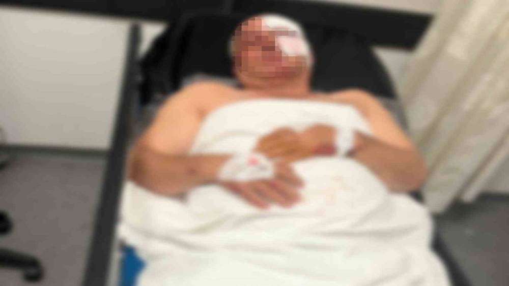 Motosiklet kazasında yaralandı, kardeşinin &ccedil;arptığını iddia etti
