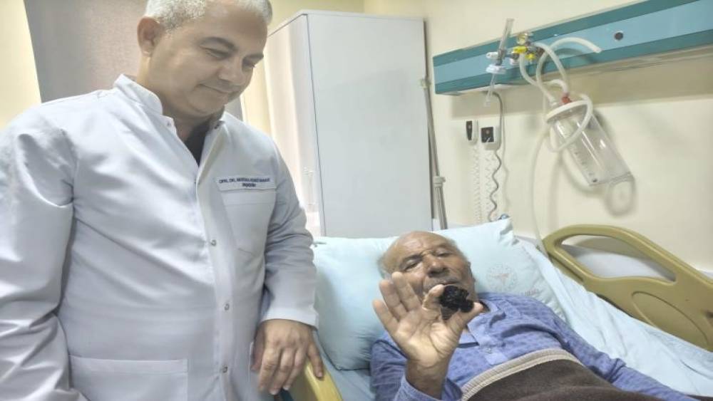 Bozyazı&rsquo;da 4 santimetrelik mesane taşı tek par&ccedil;a halinde &ccedil;ıkarıldı.
