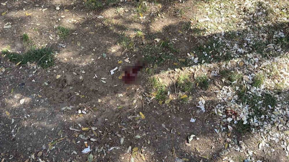 Parkta bir kişiyi d&ouml;ner bı&ccedil;ağıyla yaralayan saldırgan yakalandı
