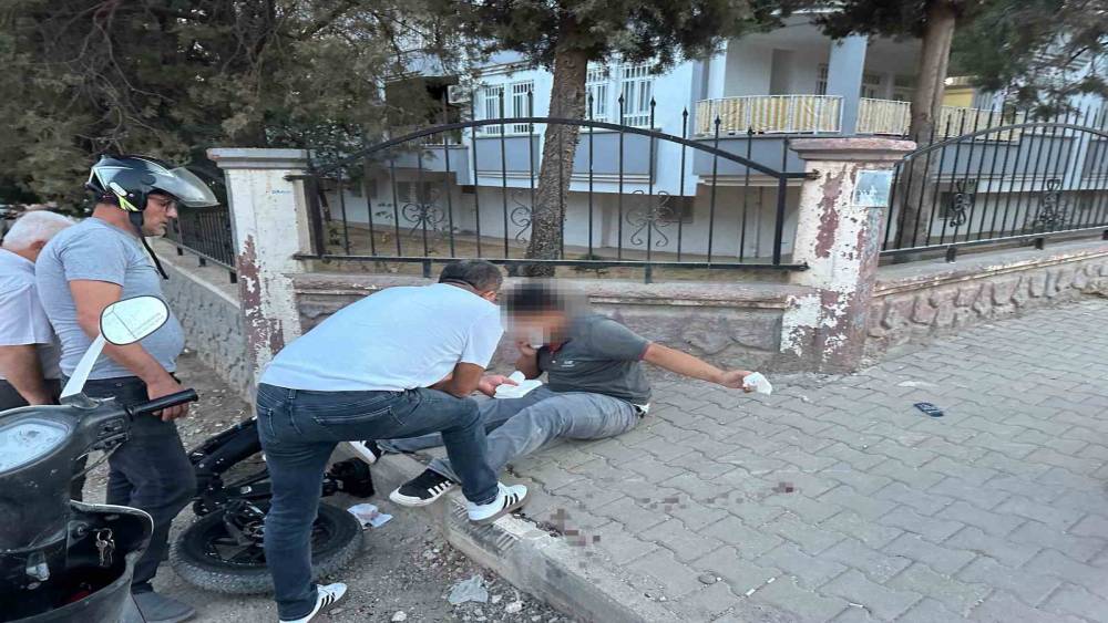 Elektrikli bisiklet duvara &ccedil;arptı: 1 yaralı
